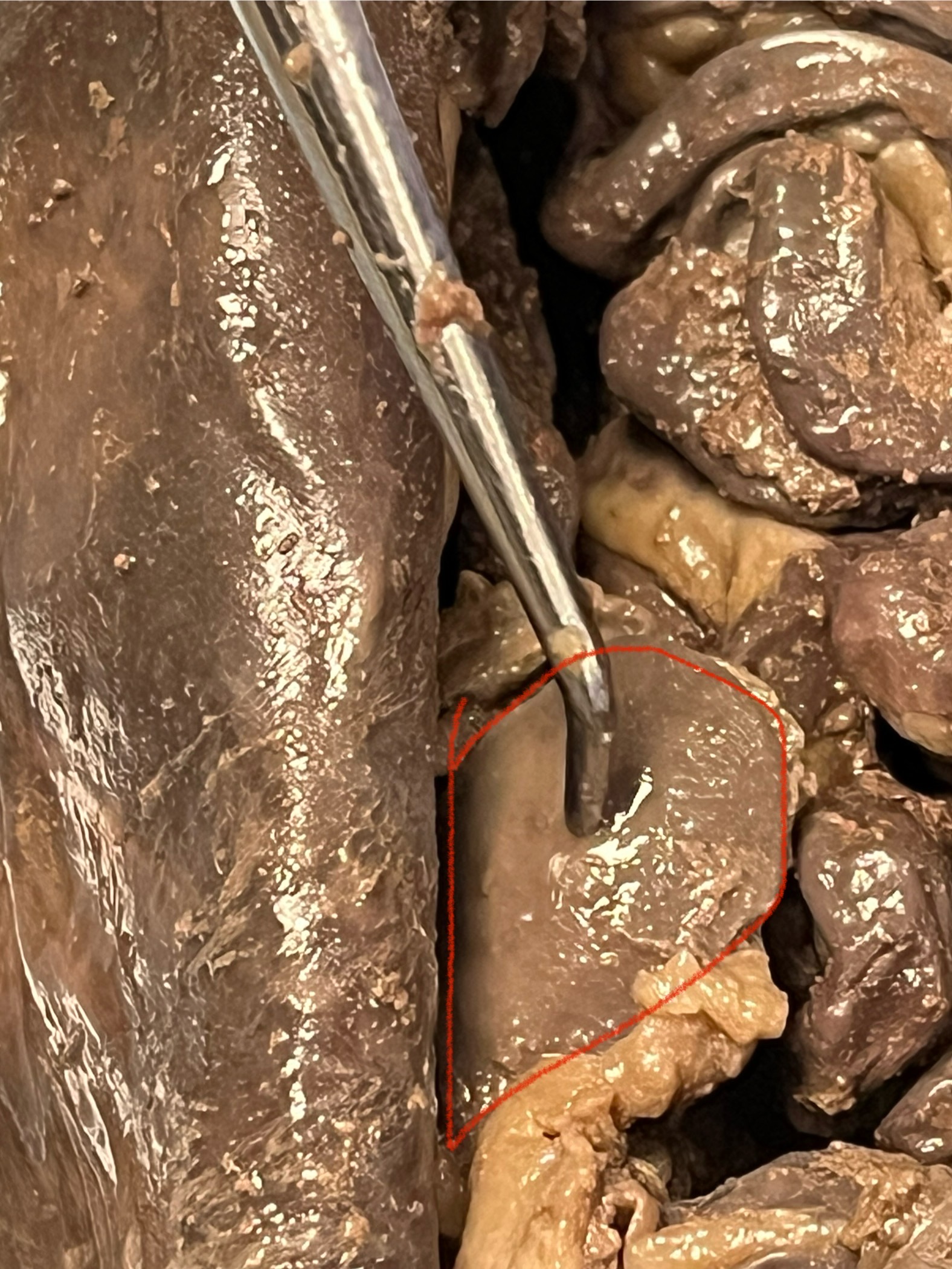 term image