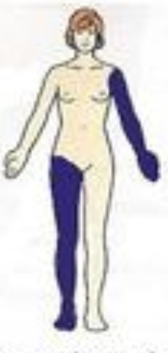 <p>Structures found on opposite sides of the body</p><p>Ex) The right hand is contralateral to the left leg.</p>