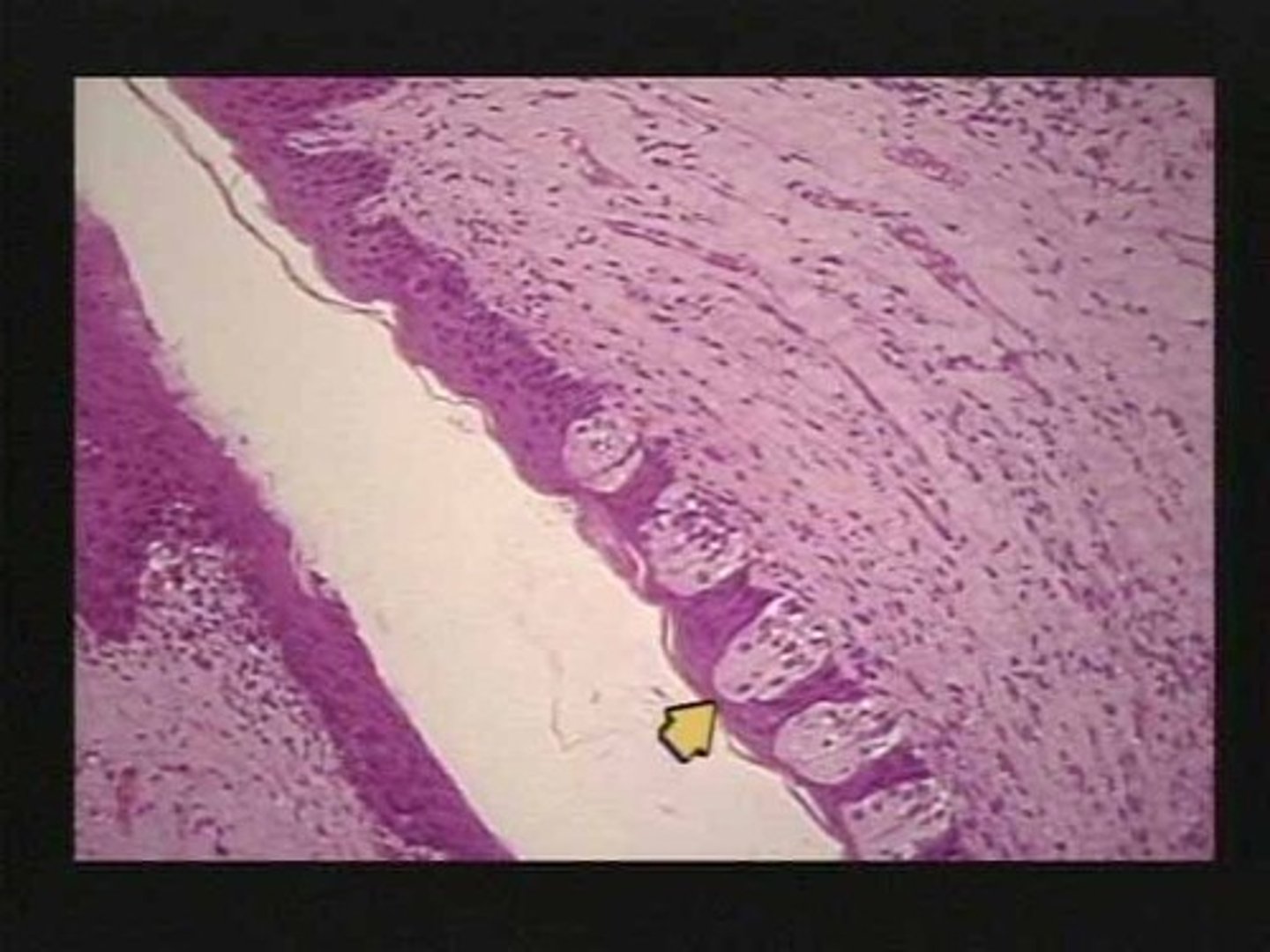 <p>sensory organs in the mouth that contain the receptors for taste</p>
