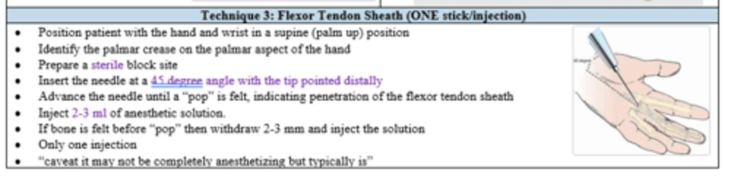 <p>Flexor tendon sheath (technique 3)</p><p>- palm up</p><p>- identify palmer crease</p><p>- inject at 45 deg until "pop"</p>