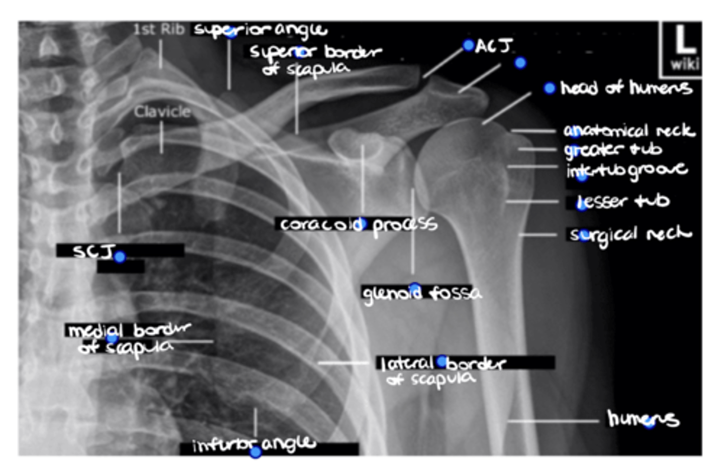 <p>ID the missing structure.</p>