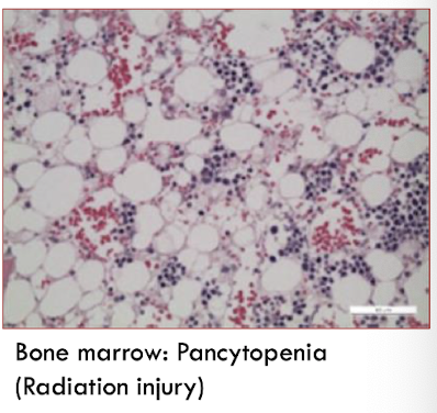<p>megakaryocyte damage or destruction</p><p>radiation, estrogen toxicity, cytotoxic drugs, viral diseases (parvo)</p>