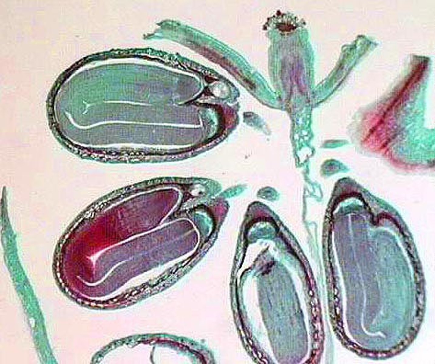 <p>two cotyledons obvious, developed hypocotyl-root axis</p>