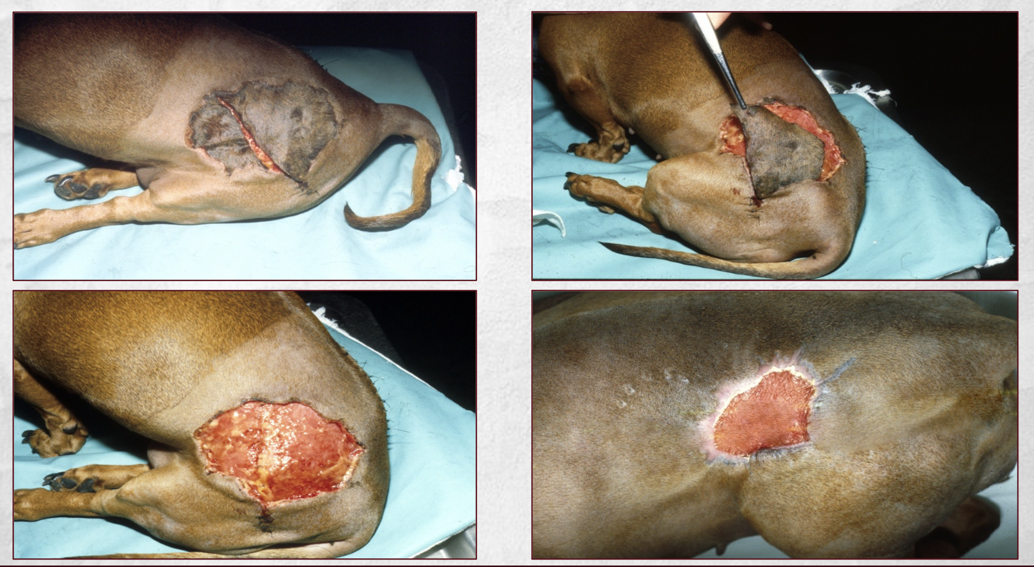 <p>-dirty or infected wounds</p><p class="p1">-large wounds</p><p class="p1">-granulation, epithelialization, contracture</p>