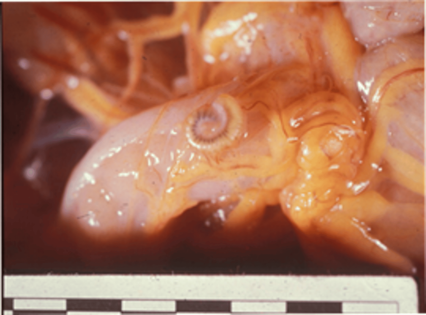 <p>Upon necropsy of a recently acquired cynomologous macaque the following lesion was noticed. What is the etiology for this condition?</p><p>a.Strongyloidiasis</p><p>b.Nochtia nocti</p><p>c.Hydatid cyst</p><p>d.Cysticercosis</p><p>e.Pentastomes</p>