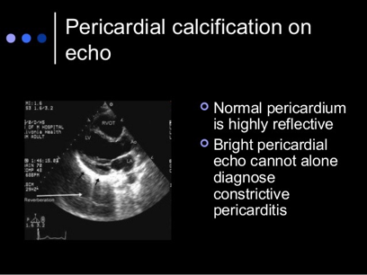<p>What does this refer to </p><ul><li><p>Pericardial thickening/calcification</p></li><li><p>Exclude restrictive cardiomyopathy</p></li></ul><p></p>