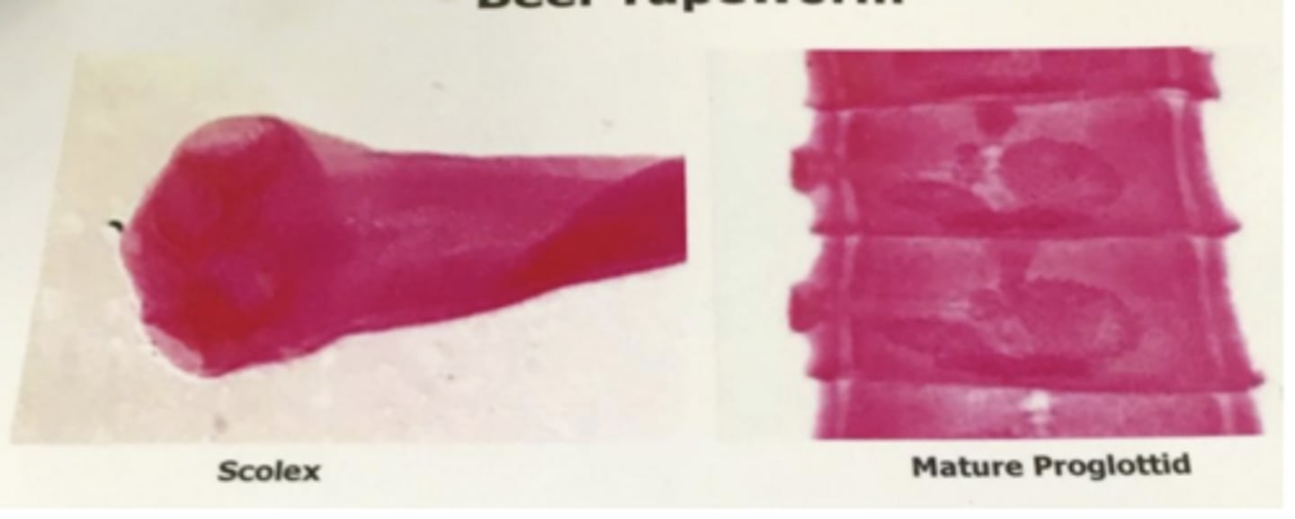 <p>Taenia (tapeworm) - cestode</p>