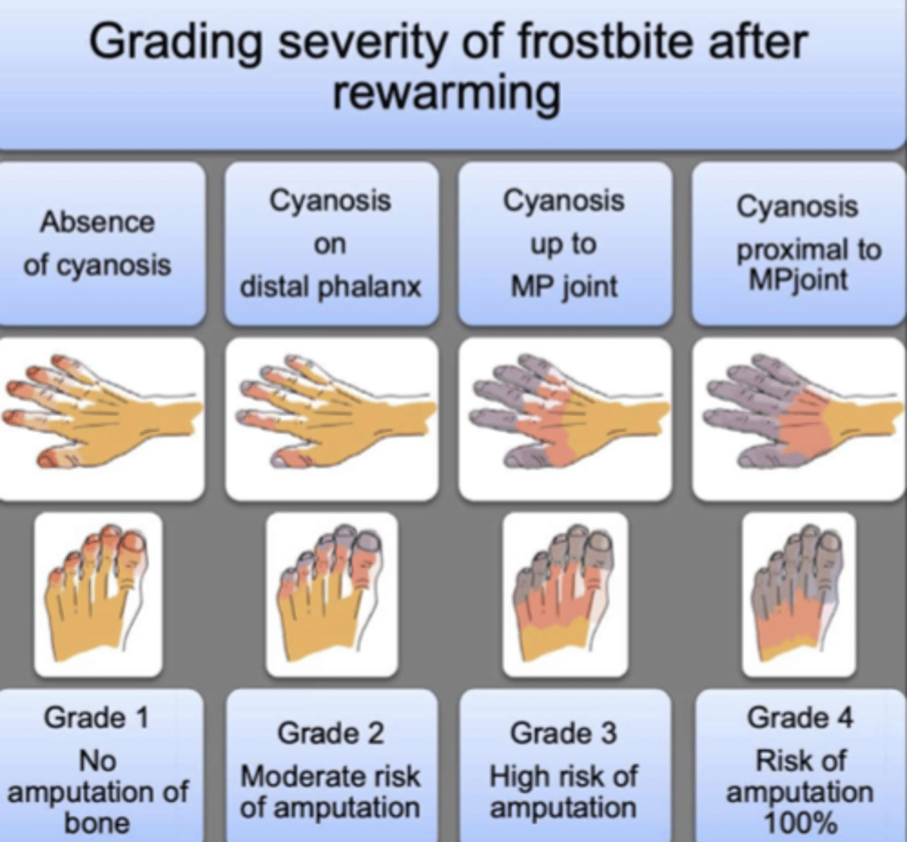 <p>- Grade 1: absence of cyanosis - no amputation of bone</p><p>- Grade 2: cyanosis on DISTAL phalanx - moderate risk of amputation</p><p>- Grade 3: cyanosis up to metaphalangeal (MP) joint (eg. knuckles) - high risk of amputation</p><p>- Grade 4: cyanosis proximal to MP joint (eg. past knuckles, reaching palm) - risk of amputation 100%</p>
