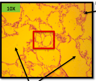 Single layer of cells, flatten and found in alveoli of the lungs

In alveoli is where CO2 and O2 exchanges >> the flatten of cell is what allow the exchange