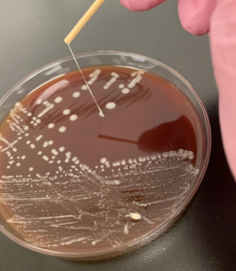 <p>what organism is this</p>