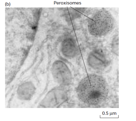<p>TEM of a liver tissue</p>