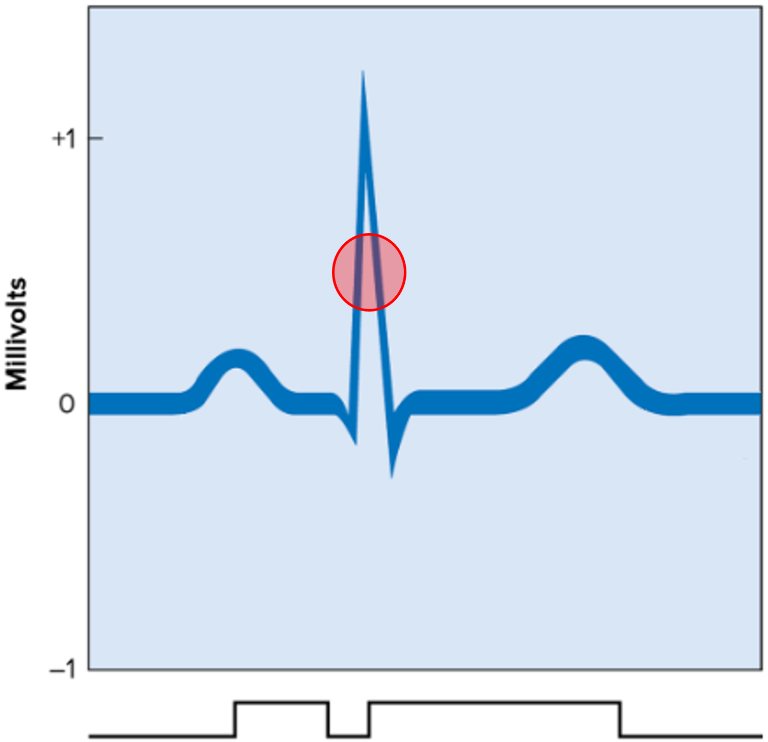 • A deflection wave of the ECG.

• Represents ventricular depolarization before ventricular contraction.

• Obscures atrial repolarization.