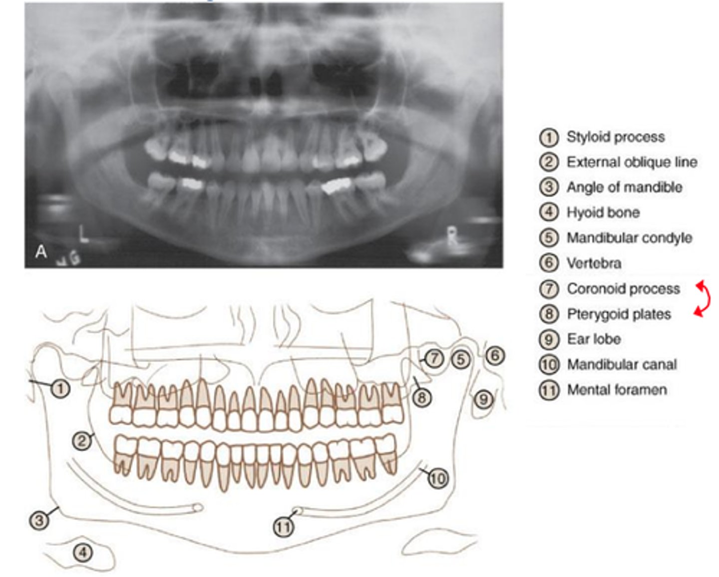 <p>provides full view of the upper &amp; lower jaw</p>