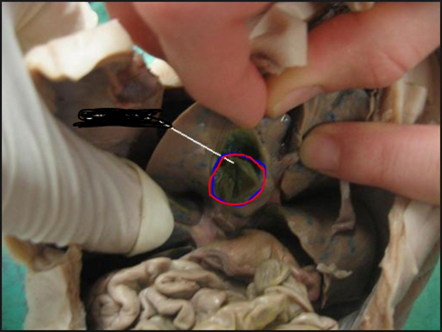 <p>name this organ found beneath the liver</p>