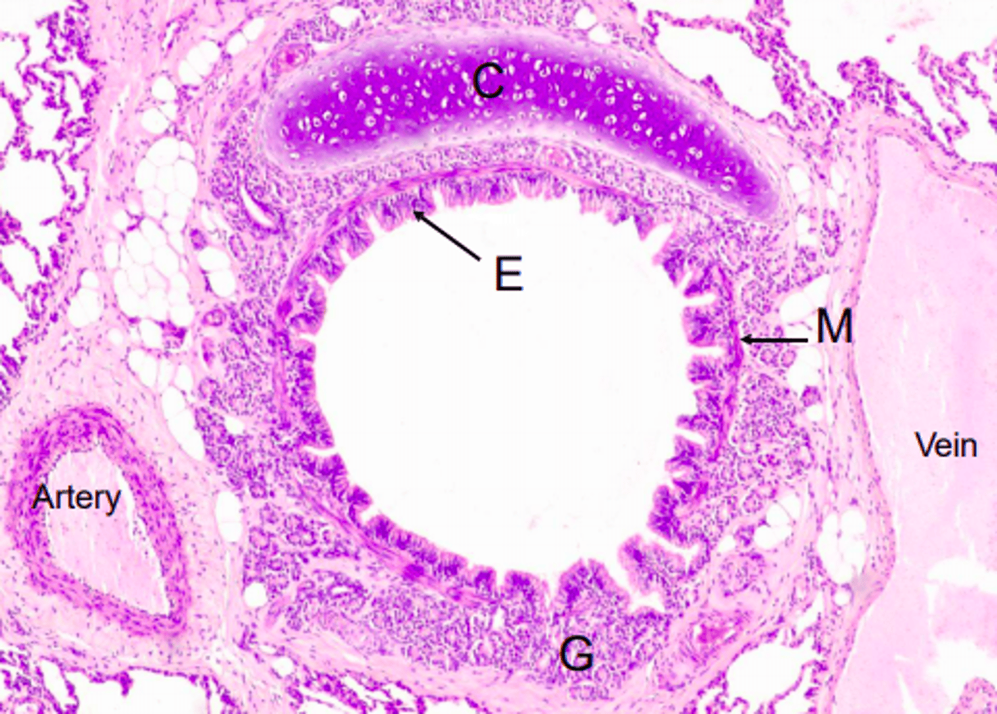 <p>E = Epithelium (pseudostratified ciliated columnar)</p><p>M = Smooth muscle</p><p>G = Glands in submucosa</p><p>C = Crescent-shaped hyaline cartilage </p>