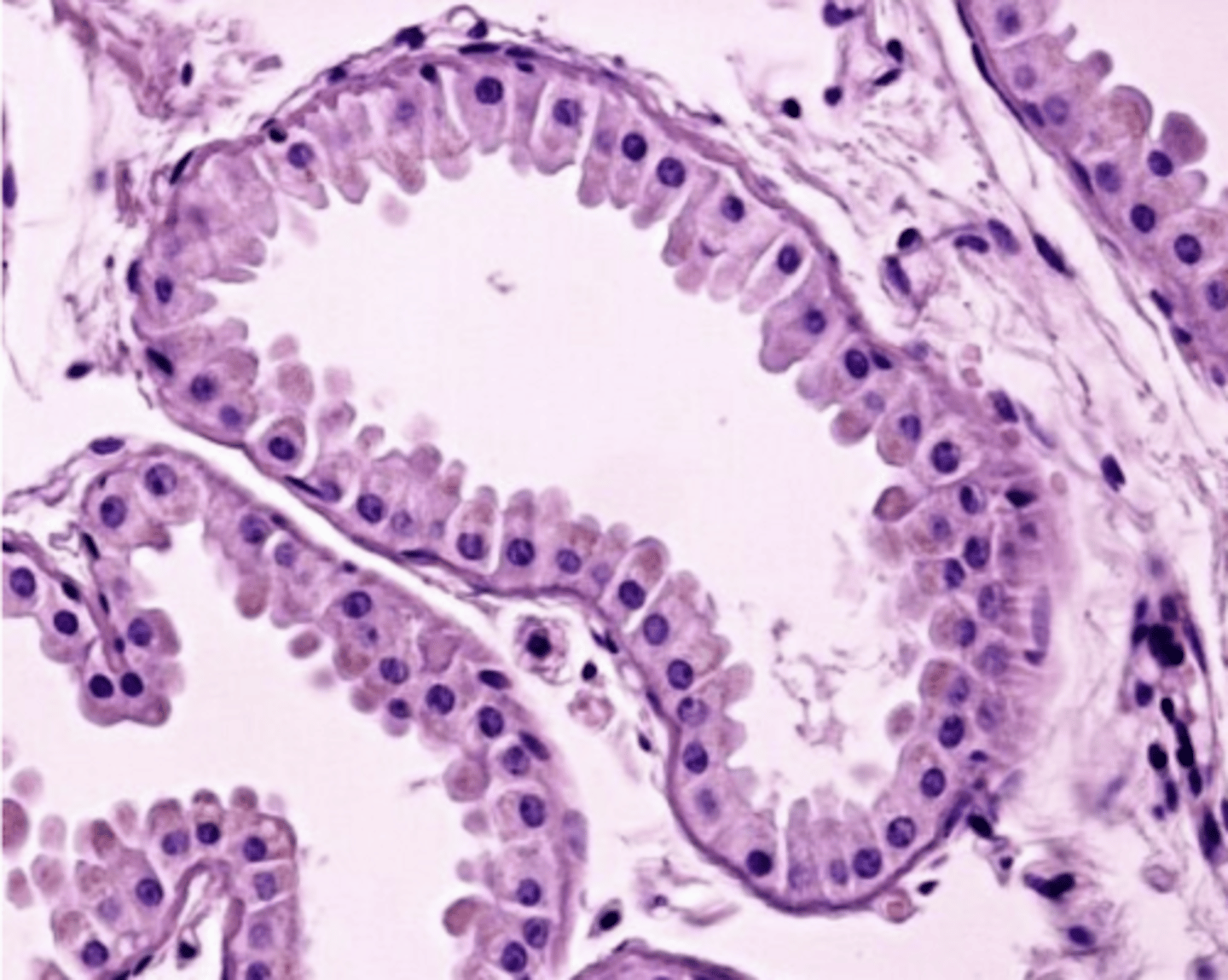 <p>apocrine sweat gland. describe it.</p>