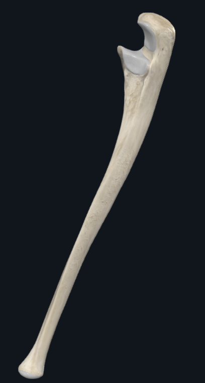 <p>What bone is this?</p>