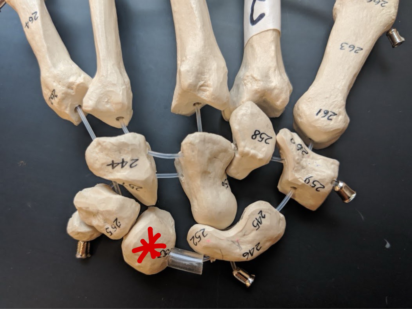 <p>Name this bone</p>