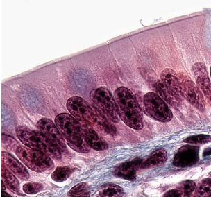 <p>Identify this epithelial tissue, where it is found, and its function.</p>
