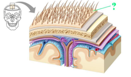 <p><span><span>Identify the indicated part of the coverings of the brain.</span></span></p>
