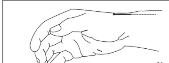 <p>Upper 4 (think thumbs up)</p>