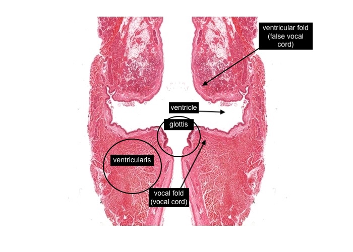 <p><span style="font-size: medium"><br>In the true anatomical position each vocal fold is oriented in an anterio-posterior direction (front-to-back; ventral-dorsal). &nbsp;In this frontal image (with a little bit of "fiddling" with the histological section image) each vocal fold has been cross-sectioned.</span></p><p><span style="font-size: medium">Each vocal fold (vocal cord) together with the opening between them is the "glottis".</span></p><p><span style="font-size: medium">The recess superior to each fold is the ventricle and the fold above this ventricle is the ventricular fold (or false vocal cord).</span></p><p><span style="font-size: medium">The tissue below the vocal fold (vocal cord) and lateral to the ventricle and also a little superio-lateral to the ventricular fold (false vocal cord) is the vocalis muscle which would also include in a particular region (see later item) the vocal ligament.</span></p>