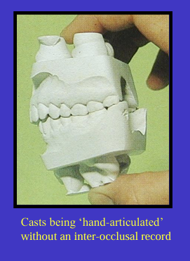 <p>if there are enough good contacts in the ICP there may not be a need to take an inter-occlusal record</p><ul><li><p>in fact, it may actually <strong>deflect</strong> the casts from their correct position so sometimes we avoid taking one </p></li></ul><p>“Sometimes you can hand articulate the casts in front of the patient so that it matches what you are seeing in the patient’s mouth, and draw on with a pencil on the buccal surface from the upper and lower teeth and line these up when articulating when  the patient is no longer there”</p>