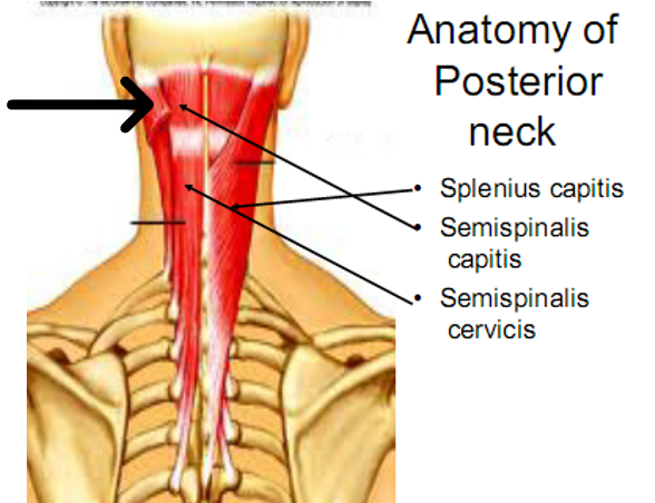 <p>innervation: occipital nerve</p><p>action: extend the head</p>