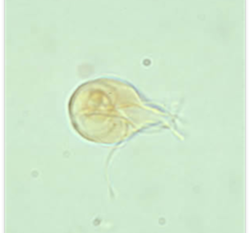 <p>Host: dogs, cats, ruminants Location: intestinal mucosa Transmission: ingestion of oocysts Diagnosis: standard fecal float Treatment: metronidazole, fenbendazole Common name: giardia zoonotic? yes key fact: diarrhea will occur in 5 days if testing fecal float, results are more prominent in one week shether&apos;s solution and zinc sulfate are both good flotation solutions</p>