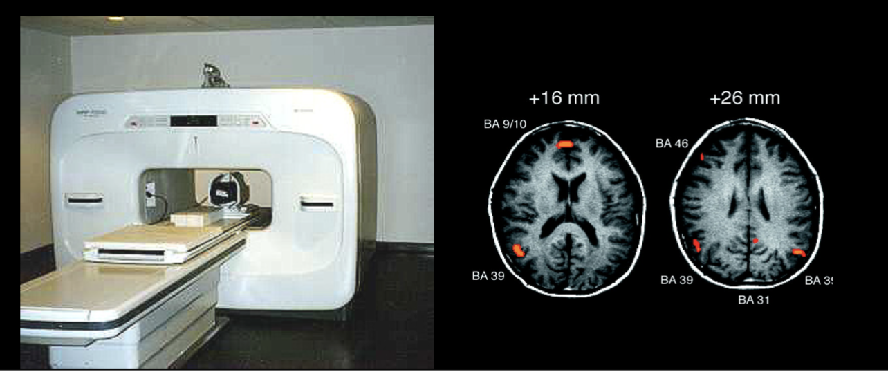 <ul><li><p>Magnetic detectors amount of hemoglobin and oxygen in different areas of the brain&nbsp;</p></li><li><p>Highly active areas of the brain appear to use more oxygen&nbsp;</p></li><li><p>Indicate where blood flows in brain for specific cognitive processing, based on magnetism&nbsp;</p></li><li><p>Used to develop brain regions maps&nbsp;</p></li></ul><p></p>