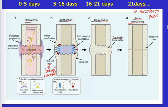 <ul><li><p>bone does not actually heal</p><ul><li><p>other cell/tissue types are activate to make new bone to unite ends of the break</p></li><li><p>periosteum and marrow</p></li></ul></li><li><p>re-engage endochonral ossification (normally rapid in healthy tissue)</p><ul><li><p>problems include malunion, nonunion, or critical defect</p></li></ul></li></ul><p></p>
