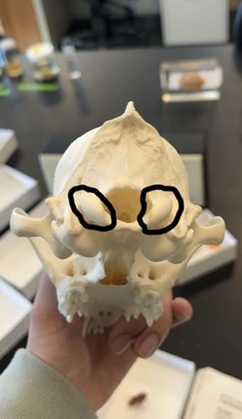 <p>part of the joint between the skull and first cervical neck vertebra</p>