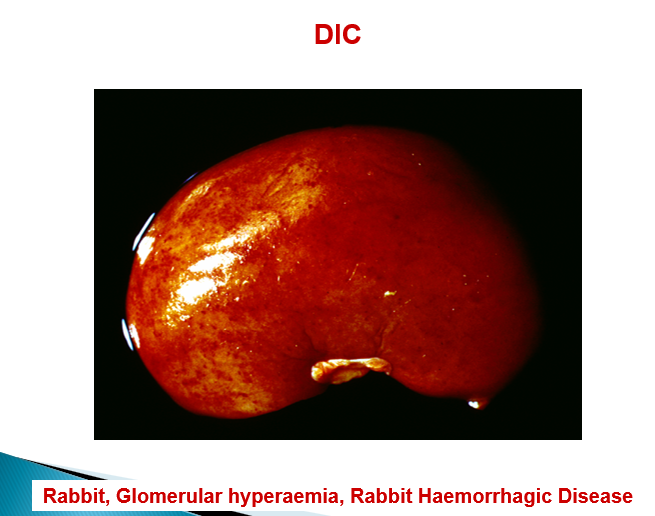 <p>Massive necrosis of hepatocytes, DIC</p>