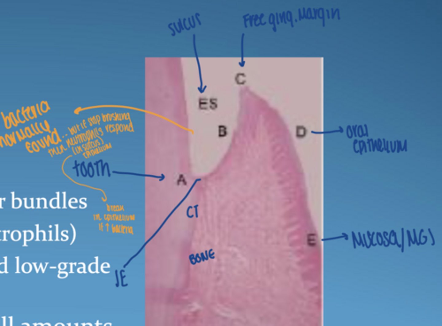 <p>CT:</p><p>-densely packed collagen fiber bundles</p><p>-few inflammatory cells (neutrophils)</p><p>-balanced host-bacteria interaction</p><p>- gingival crevicular fluid in small amounts</p>