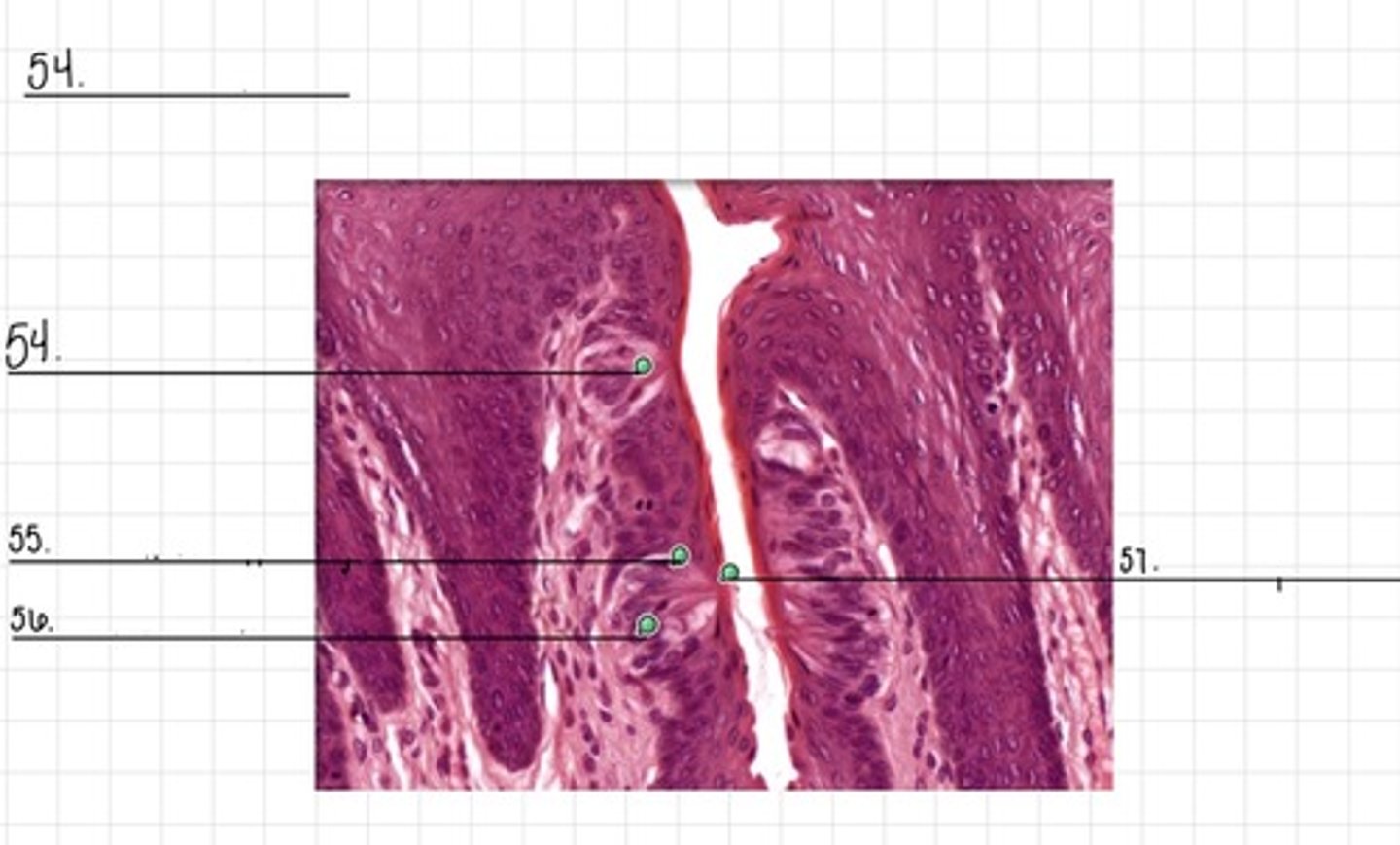 <p>55</p>