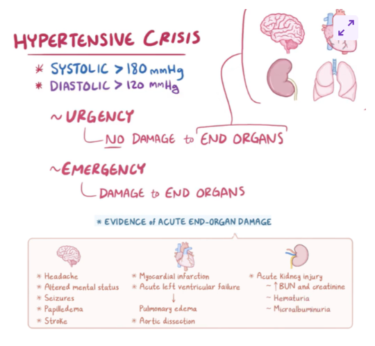 <p>hypertensive crisis is a severe and rapidly progress in form of hypertension</p>