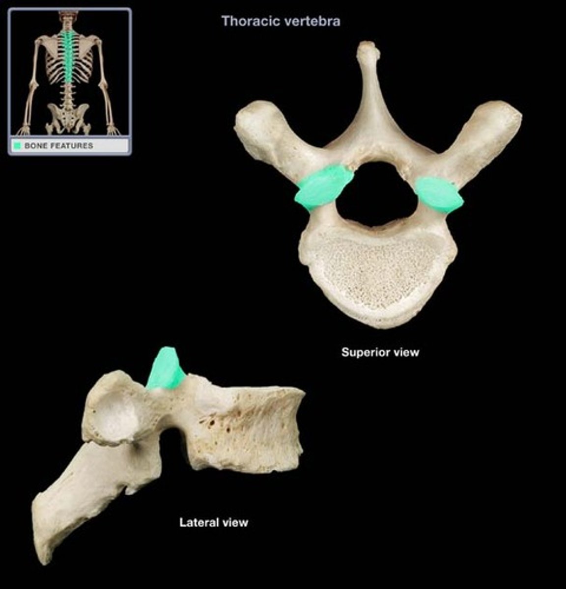 <p>2 Superior Articular process (interlock with vertebra above)</p>
