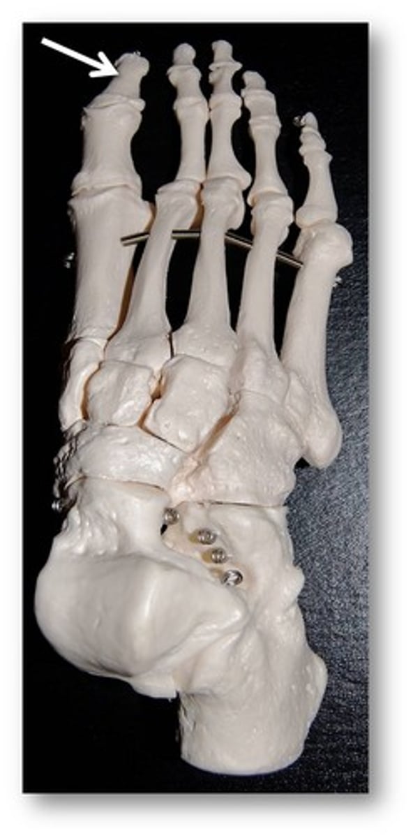 <p>ID specific bone</p>