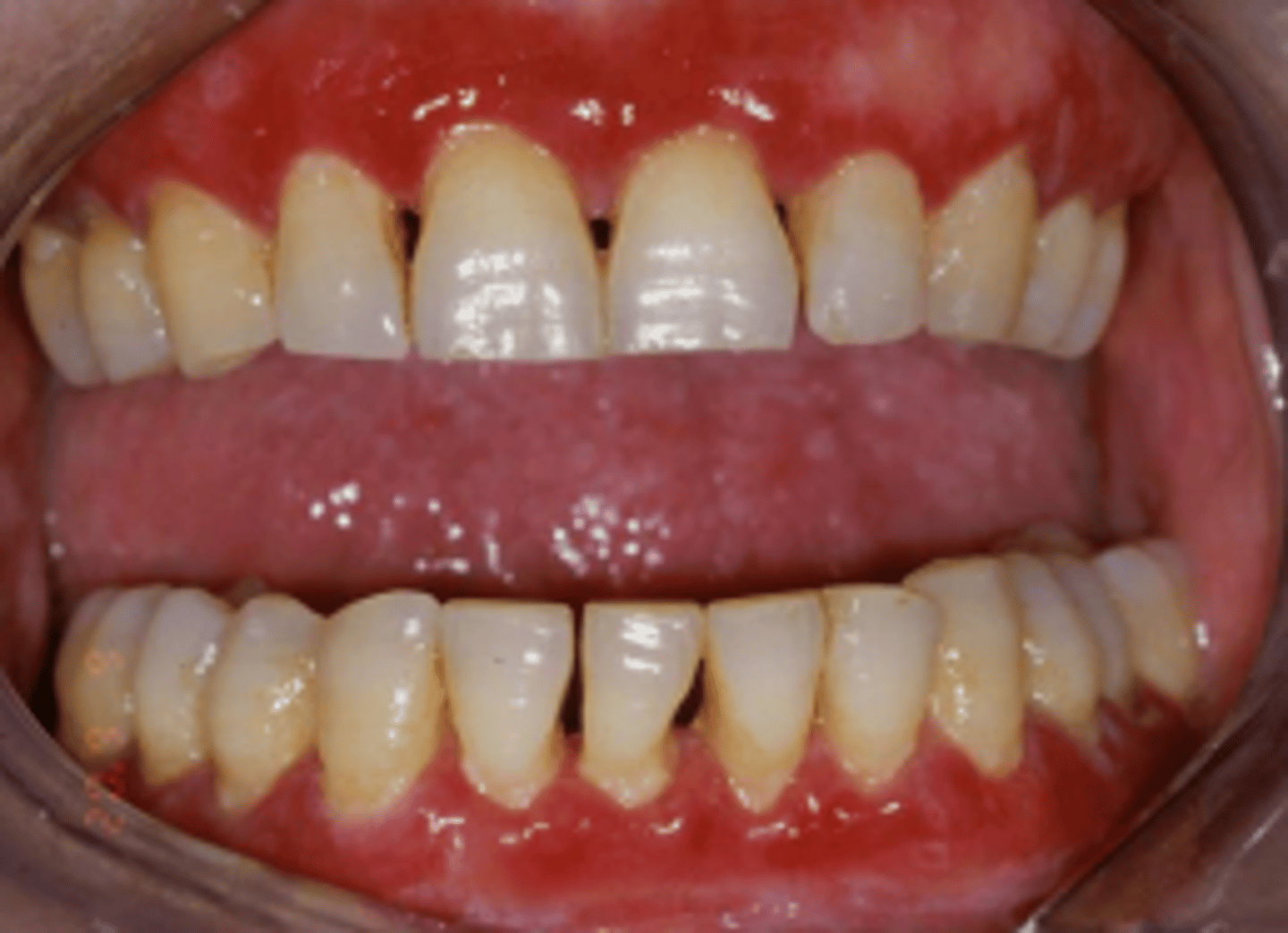 <p>Describe the appearance of the lesions:</p>