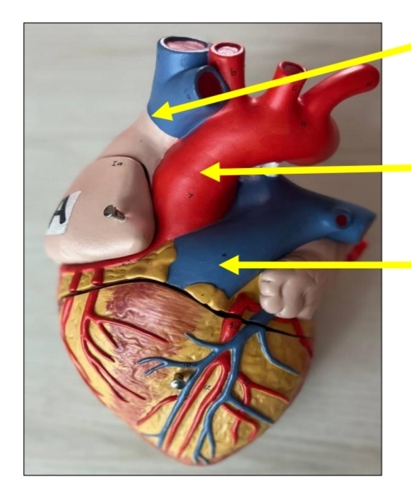 <p>identify respectively</p><p>What is type of blood carried in this blood vessels</p><p>From where this blood vessels arise </p><p>Where does this blood vessels ends</p>