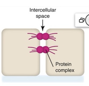 <p>What type of junctional complex is this?</p>