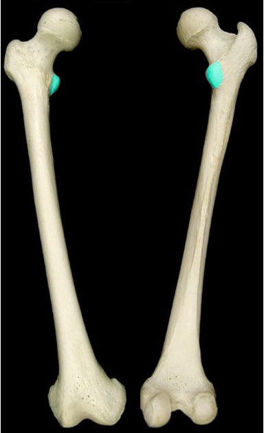 <p>small projection on the medial/head side of the femur</p>