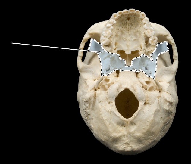 <p>Name this bone.</p><p>(Skull, inferior view).</p>
