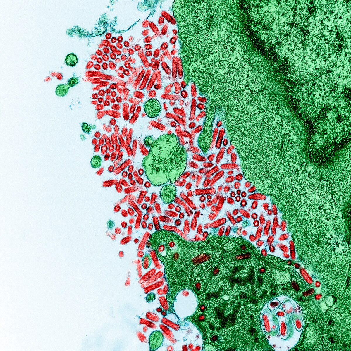 <p>rabies virus, varicella zoster </p>