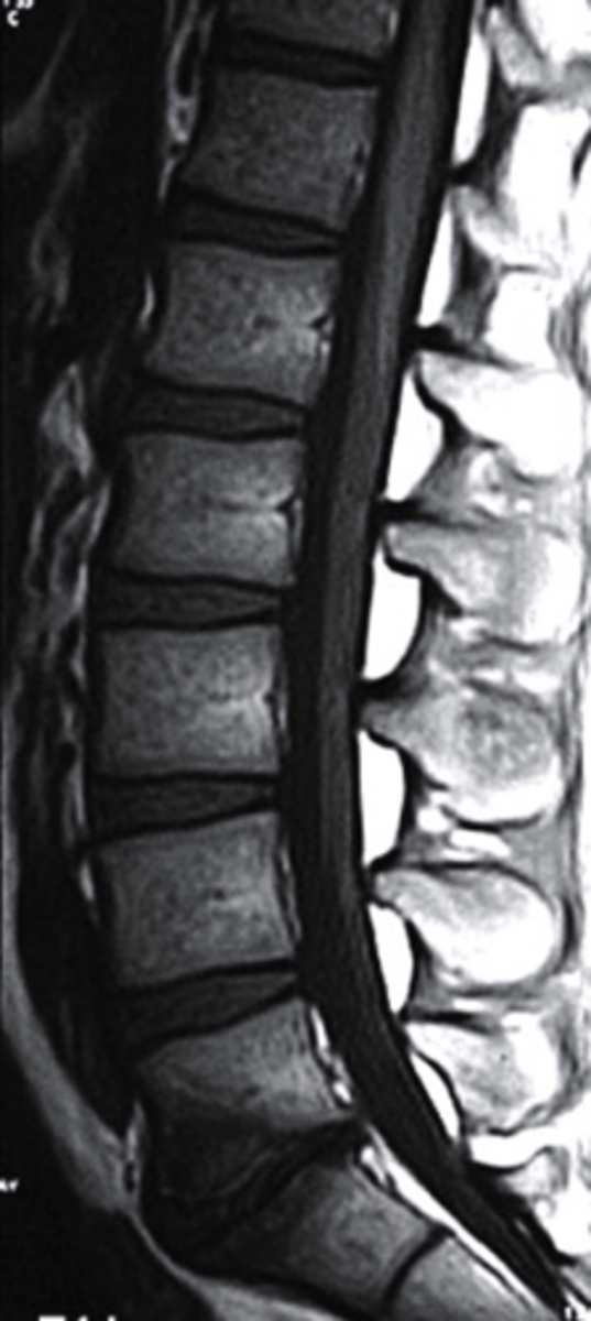 <p>what type of imaging is this?</p><p>a. T2 MRI</p><p>b. CT Scan</p><p>c. Radiograph</p><p>d. T1 MRI</p>