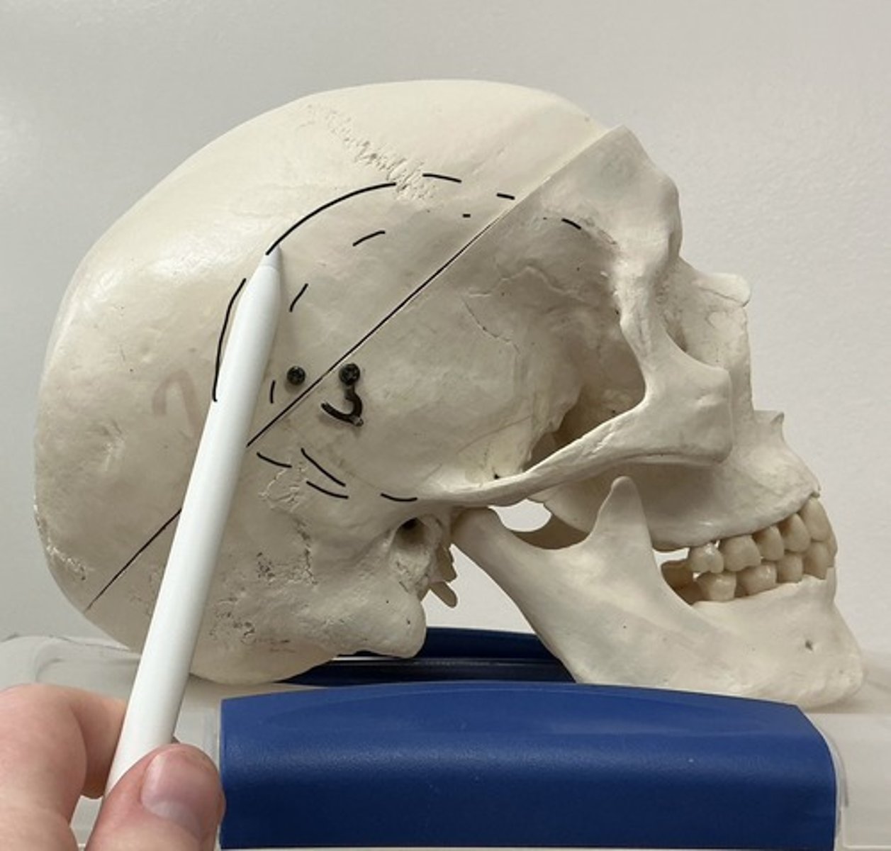 <p>What is the arrow pointing to?</p>