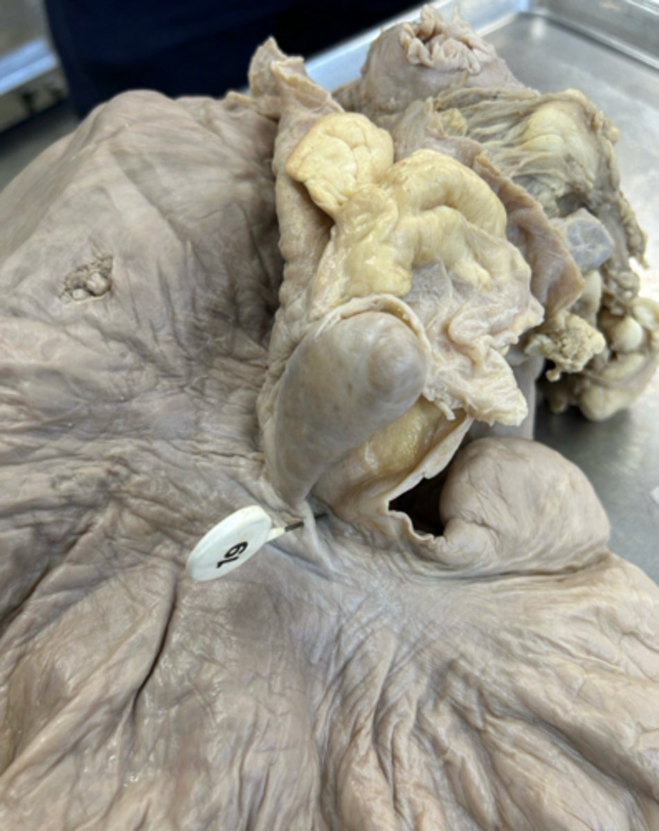 <p>What 2 structures does this ligament connect?</p>