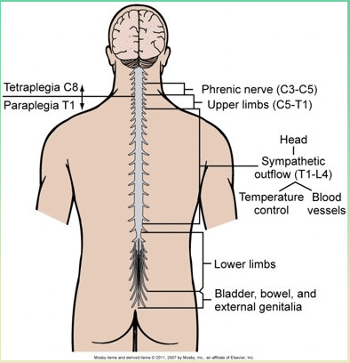 <p>- sx depend on the degree of paralysis</p><p>- potential for rehab depends on the level of injury</p>