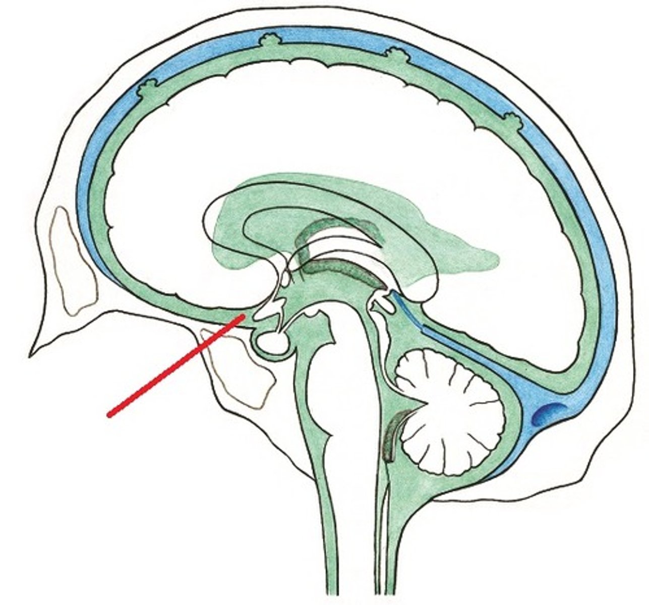 <p>cistern that surrounds the optic chiasm</p>