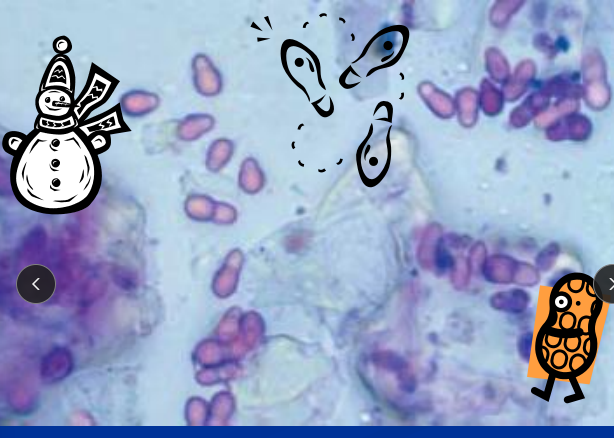 <p><span>Malassezia</span></p>